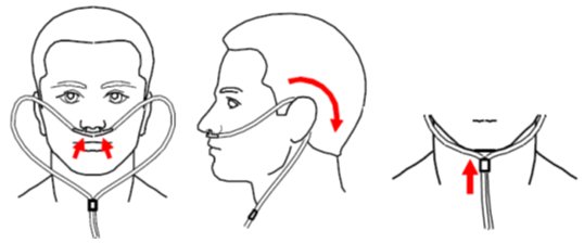 How to insert on sale nasal cannula